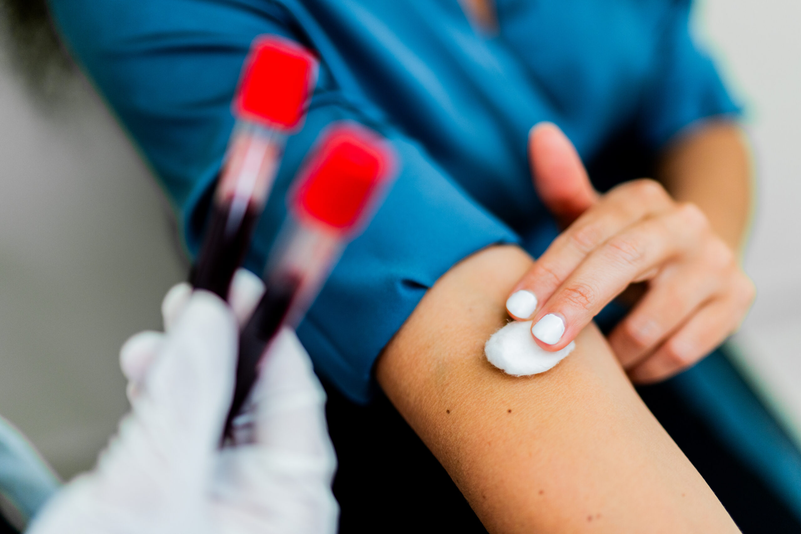 A healthcare professional holds two bags of orange liquid, likely a blood component, while wearing gloves in a clinical setting.